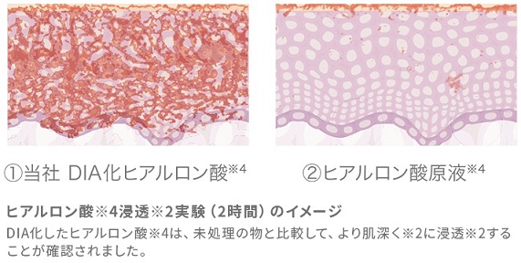 メディカルプルーフ　ヒアルロン酸　比較